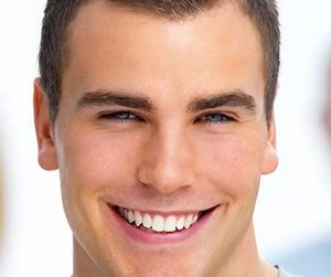 dental crown and bridges