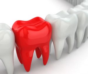 Emergency dentist in Clinton NJ