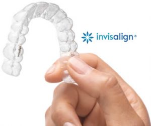 Invislaign in Clinton NJ